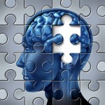 Alzheimers